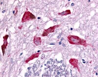 Immunohistochemistry-Paraffin: PAK5 Antibody [NLS7963] - Analysis of anti-PAK7 antibody with human brain, substantia nigra neurons.