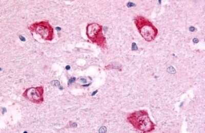 Immunohistochemistry-Paraffin: PAK5 Antibody [NLS7963] - Anti-PAK7 antibody IHC of human brain, thalamus neurons. Immunohistochemistry of formalin-fixed, paraffin-embedded tissue after heat-induced antigen retrieval.