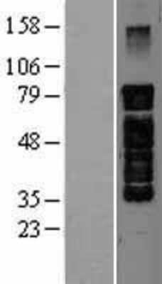 Western Blot: PAK5 Overexpression Lysate (Adult Normal) [NBL1-14084] Left-Empty vector transfected control cell lysate (HEK293 cell lysate); Right -Over-expression Lysate for PAK5.