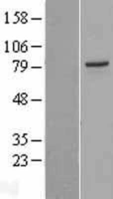 Western Blot: PAK5 Overexpression Lysate (Adult Normal) [NBL1-14085] Left-Empty vector transfected control cell lysate (HEK293 cell lysate); Right -Over-expression Lysate for PAK5.