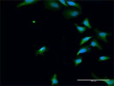 Immunocytochemistry/Immunofluorescence: PAK6 Antibody [H00056924-D01P] - Analysis of antibody to PAK6 on HeLa cell. Antibody concentration 20 ug/ml.
