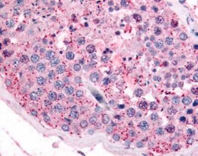 Immunohistochemistry-Paraffin: PAK6 Antibody [NBP1-02657] - Staining of human testis. Immunohistochemistry of formalin-fixed, paraffin-embedded tissue after heat-induced antigen retrieval. Antibody concentration 10 ug/ml.