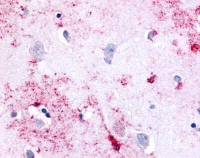 Immunohistochemistry-Paraffin: PAK6 Antibody [NLS6942] - Analysis of anti-PAK6 antibody with human brain, neurons and glia at 3.5 ug/ml.