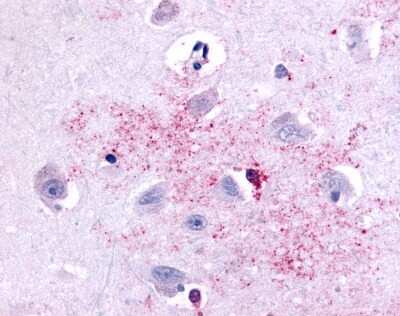 Immunohistochemistry-Paraffin: PAK6 Antibody [NLS7962] - Analysis of anti-PAK6 antibody with human brain, neurons and glia.