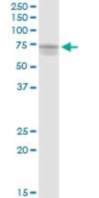Western Blot: PAK6 Antibody [H00056924-D01P] - Analysis of PAK6 expression in HeLa.