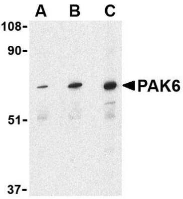 Western Blot PAK6 Antibody - BSA Free