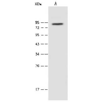 Western Blot: PAK6 Antibody [NBP2-99551] - Anti-PAK6 rabbit polyclonal antibody at 1:500 dilution. Lane A: Mouse brain tissue lysate Lysates/proteins at 30 ug per lane. Secondary Goat Anti-Rabbit IgG (H+L)/HRP at 1/10000 dilution. Developed using the ECL technique. Performed under reducing conditions. Predicted band size: 75 kDa