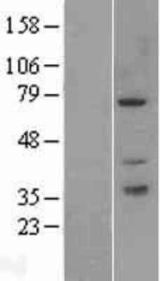 Western Blot PAK6 Overexpression Lysate