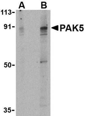 Western Blot PAK7 Antibody - BSA Free