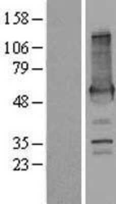 Western Blot: AKAP2 Overexpression Lysate [NBP2-08551] - Left-Empty vector transfected control cell lysate (HEK293 cell lysate); Right -Over-expression Lysate for AKAP2.