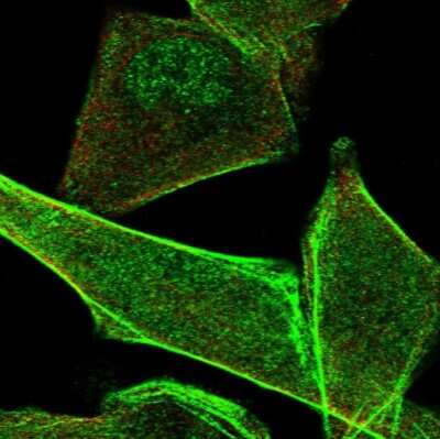 Immunocytochemistry/Immunofluorescence: PALMD Antibody [NBP1-88481] - Staining of human cell line RH-30 shows localization to nucleoplasm & actin filaments. Antibody staining is shown in green.
