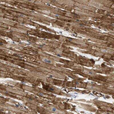 Immunohistochemistry-Paraffin PALMD Antibody - BSA Free