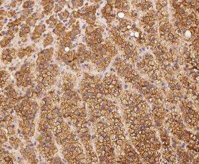 Immunohistochemistry-Paraffin PALMD Antibody - BSA Free