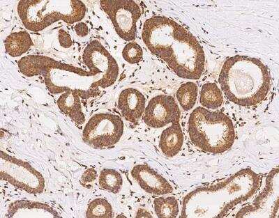 Immunohistochemistry-Paraffin PALMD Antibody - BSA Free