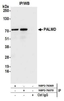 Immunoprecipitation: PALMD Antibody [NBP2-76369] - Detection of human PALMD by western blot of immunoprecipitates. Samples: Whole cell lysate (1.0 mg per IP reaction; 20% of IP loaded) from HeLa cells prepared using NETN lysis buffer. Antibodies: Affinity purified rabbit anti-PALMD antibody NBP2-76369 used for IP at 100 ul per reaction. PALMD was also immunoprecipitated by rabbit anti-PALMD antibody NBP2-76370. For blotting immunoprecipitated PALMD, NBP2-76369 was used at 1:100. Detection: Chemiluminescence with an exposure time of 1 second.