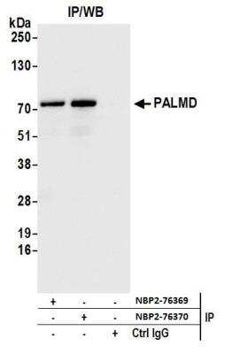 Immunoprecipitation: PALMD Antibody [NBP2-76370] - Samples: Whole cell lysate (1.0 mg per IP reaction; 20% of IP loaded) from HeLa cells prepared using NETN lysis buffer. Antibodies: Affinity purified rabbit anti-PALMD antibody NBP2-76370 used for IP at 15 ul per reaction. PALMD was also immunoprecipitated by rabbit anti-PALMD antibody NBP2-76369. For blotting immunoprecipitated PALMD was used at 1:100. Detection: Chemiluminescence with an exposure time of 1 second.
