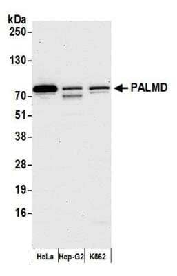 Tissue Culture Substratum: PALMD Antibody [NBP2-76369] - Samples: Whole cell lysate (15 ug) from HeLa, Hep-G2, and K562 cells prepared using NETN lysis buffer. Antibody: Affinity purified rabbit anti-PALMD antibody NBP2-76369 used for WB at 1:1000. Detection: Chemiluminescence with an exposure time of 30 seconds.