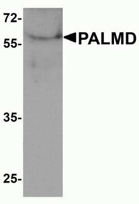 Western Blot: PALMD Antibody [NBP2-82018] - Western blot analysis of PALMD in human bladder tissue lysate with PALMD antibody at 1 ug/ml.