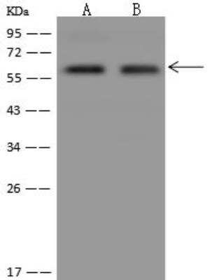 Western Blot PALMD Antibody - BSA Free