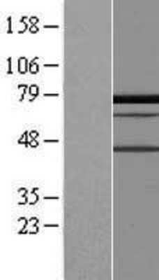 Western Blot PALMD Overexpression Lysate