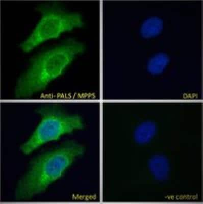 Immunocytochemistry/ Immunofluorescence PALS1/MPP5 Antibody