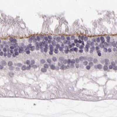 Immunohistochemistry-Paraffin: PALS1/MPP5 Antibody [NBP2-68812] - Immunohistochemical staining of human retina shows positivity in outer limiting membrane.