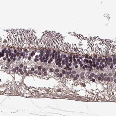 Immunohistochemistry-Paraffin: PALS1/MPP5 Antibody [NBP1-83716] - Staining of human retina shows positivity in outer limiting membrane.