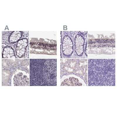 <b>Independent Antibodies Validation. </b>Immunohistochemistry-Paraffin: PALS1/MPP5 Antibody [NBP1-83716] - Staining of human colon, eye, retina, kidney and lymph node using Anti-MPP5 antibody NBP1-83716 (A) shows similar protein distribution across tissues to independent antibody NBP2-68812 (B).