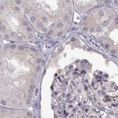 Immunohistochemistry-Paraffin: PALS1/MPP5 Antibody [NBP1-83716] - Staining of human kidney.