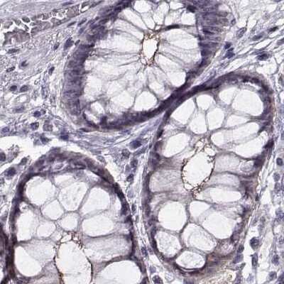 Immunohistochemistry-Paraffin: PALS1/MPP5 Antibody [NBP1-83716] - Staining of human colon.