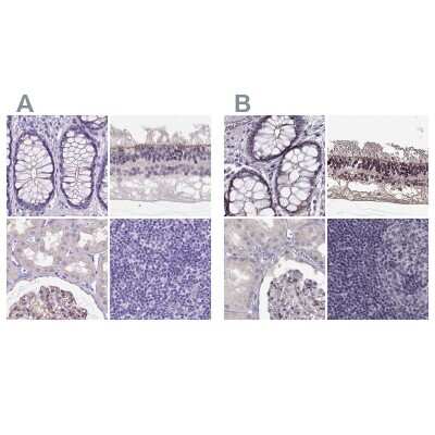 <b>Independent Antibodies Validation. </b>Immunohistochemistry-Paraffin: PALS1/MPP5 Antibody [NBP2-68812] - Staining of human colon, eye, retina, kidney and lymph node using Anti-MPP5 antibody NBP2-68812 (A) shows similar protein distribution across tissues to independent antibody NBP1-83716 (B).