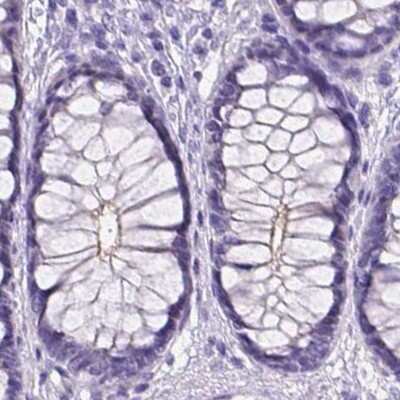Immunohistochemistry-Paraffin: PALS1/MPP5 Antibody [NBP2-68812] - Staining of human colon.