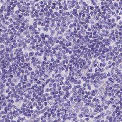 Immunohistochemistry-Paraffin: PALS1/MPP5 Antibody [NBP2-68812] - Staining of human lymph node.