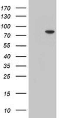 Western Blot: PALS1/MPP5 Antibody (OTI2D3) - Azide and BSA Free [NBP2-73234] - HEK293T cells were transfected with the pCMV6-ENTRY control (Left lane) or pCMV6-ENTRY MPP5 (Right lane) cDNA for 48 hrs and lysed. Equivalent amounts of cell lysates (5 ug per lane) were separated by SDS-PAGE and immunoblotted with anti-MPP5.