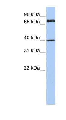 Western Blot: PALS1/MPP5 Antibody [NBP1-54724] - Jurkat cell lysate, concentration 0.2-1 ug/ml.