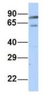 Western Blot: PALS1/MPP5 Antibody [NBP1-54724] - Human Adult Placenta, Antibody Dilution: 1.0 ug/ml.