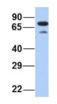 Western Blot: PALS1/MPP5 Antibody [NBP1-54724] - Human Fetal Heart, Antibody Dilution: 1.0 ug/ml.