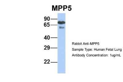 Western Blot: PALS1/MPP5 Antibody [NBP1-54724] - Human Fetal Lung, Antibody Dilution: 1.0 ug/ml.