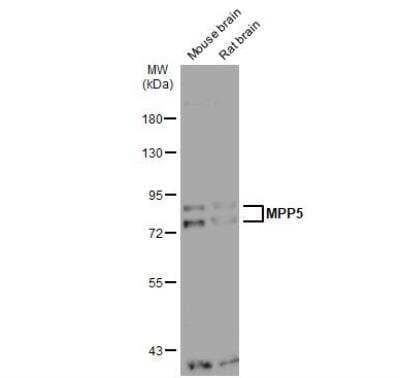 Western Blot: PALS1/MPP5 Antibody [NBP2-19389] - Various tissue extracts (30 ug) were separated by 7.5% SDS-PAGE, and the membrane was blotted with MPP5 antibody [N1N2], N-term  diluted at 1:1000. The HRP-conjugated anti-rabbit IgG antibody (NBP2-19301) was used to detect the primary antibody.