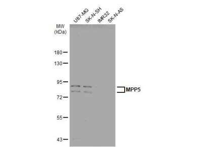 Western Blot: PALS1/MPP5 Antibody [NBP2-19389] - Various whole cell extracts (30 ug) were separated by 7.5% SDS-PAGE, and the membrane was blotted with MPP5 antibody [N1N2], N-term diluted at 1:1000. The HRP-conjugated anti-rabbit IgG antibody (NBP2-19301) was used to detect the primary antibody.