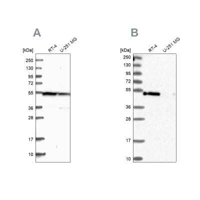 <b>Independent Antibodies Validation. </b>Western Blot: PAMCI Antibody [NBP1-80937] - Analysis using Anti-RASSF9 antibody NBP1-80937 (A) shows similar pattern to independent antibody NBP1-80938 (B).