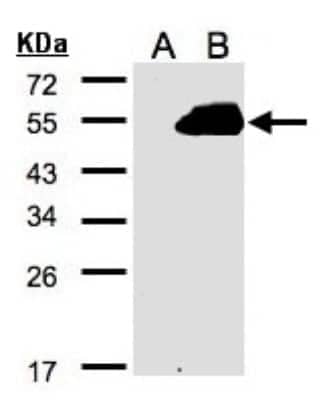 Western Blot: PAMCI Antibody [NBP2-19686] - Western Blot analysis of RASSF9 expression in transfected 293T cell line by RASSF9 polyclonal antibody. A: Non-transfected lysate. B: RASSF9 transfected lysate. 12% SDS PAGE gel, diluted at 1:500.