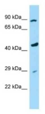 Western Blot: PAMCI Antibody [NBP3-09529] - Western blot analysis of PAMCI in Human U937 Whole Cell. Antibody dilution at 1ug/ml