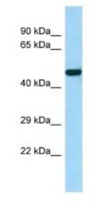 Western Blot: PAMCI Antibody [NBP3-09530] - Western blot analysis of PAMCI in Human U937 Whole Cell. Antibody dilution at 1ug/ml