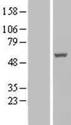 Western Blot: PAMCI Overexpression Lysate (Adult Normal) [NBL1-15181] Left-Empty vector transfected control cell lysate (HEK293 cell lysate); Right -Over-expression Lysate for PAMCI.