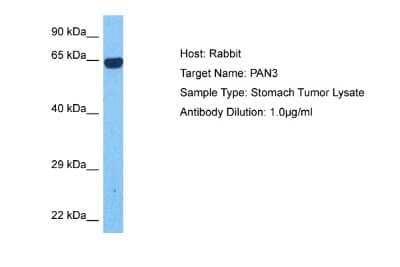 Western Blot: PAN3 Antibody [NBP2-85439] - Host: Rabbit. Target Name: PAN3. Sample Tissue: Human Stomach Tumor lysates. Antibody Dilution: 1ug/ml