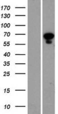 Western Blot: PANK1 Overexpression Lysate (Adult Normal) [NBP2-05420] Left-Empty vector transfected control cell lysate (HEK293 cell lysate); Right -Over-expression Lysate for PANK1.