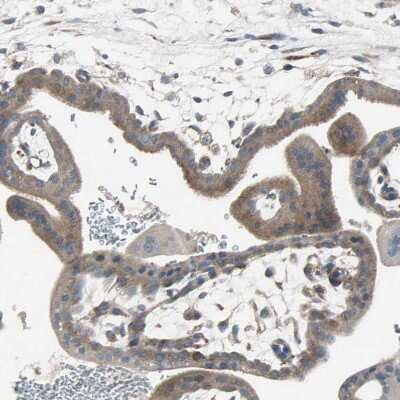 Immunohistochemistry-Paraffin: PANK2 Antibody [NBP1-88295] - Staining of human placenta shows moderate cytoplasmic positivity in trophoblastic cells.
