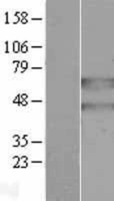 Western Blot: PANK2 Overexpression Lysate (Adult Normal) [NBL1-14091] Left-Empty vector transfected control cell lysate (HEK293 cell lysate); Right -Over-expression Lysate for PANK2.