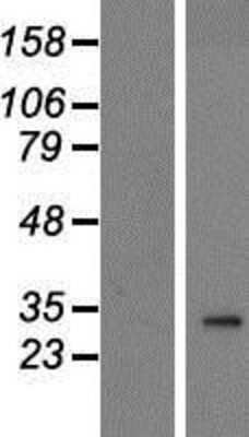 Western Blot: PANK2 Overexpression Lysate (Adult Normal) [NBP2-09917] Left-Empty vector transfected control cell lysate (HEK293 cell lysate); Right -Over-expression Lysate for PANK2.